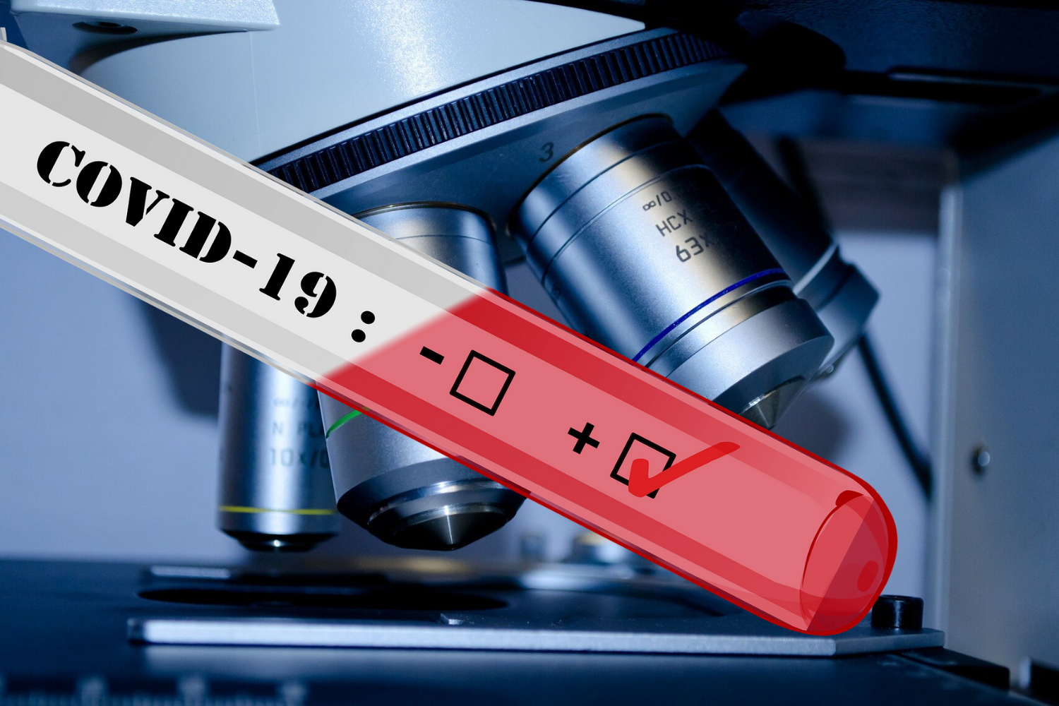 Imamo že 10 ozdravljenih, a žal 108 okuženih iz vrst zdravstvenega osebja