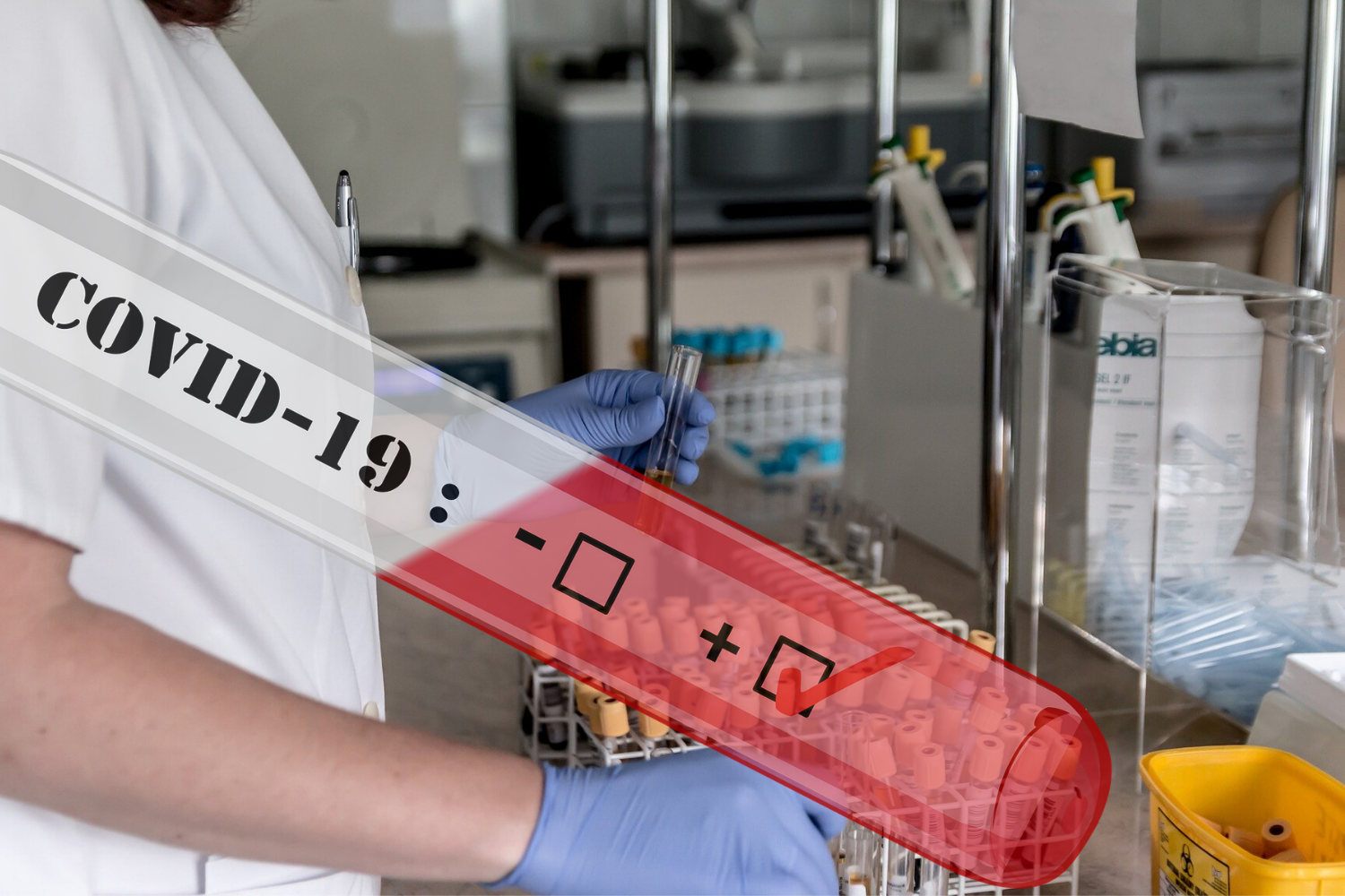 Ženske bolj dovzetne za okužbo s koronavirusom